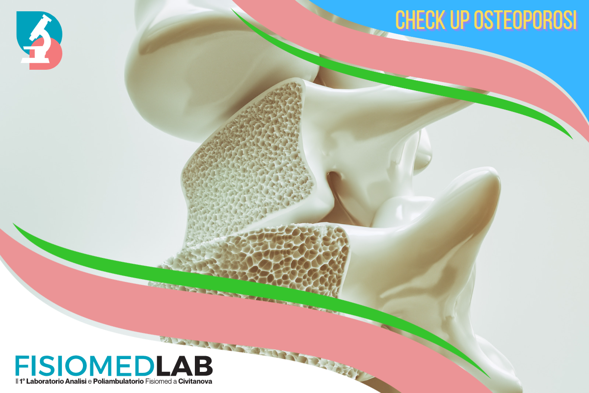 check up osteoporosi fisiomedlab